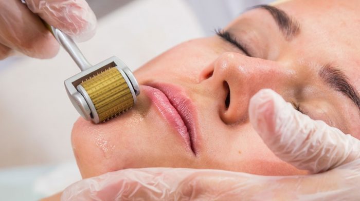 WHY YOU SHOULD PURCHASE A DERMAROLLER